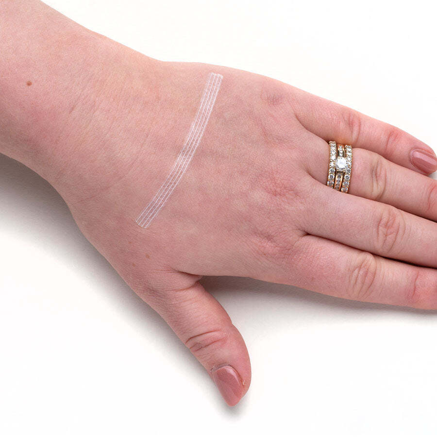 Wound closures (pack of 3)