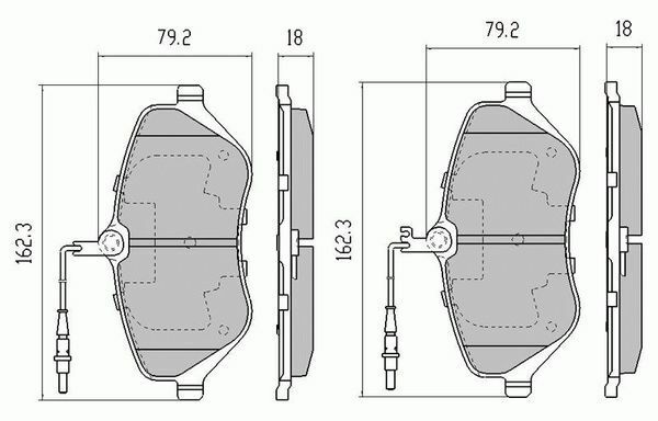 RDA Front Extreme Disc Brake Pads for Peugeot 407 2.2 & 2.7 Turbo Diesel 2005-ON